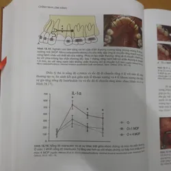 CHỈNH NHA LÂM SÀNG TẬP 1 689476