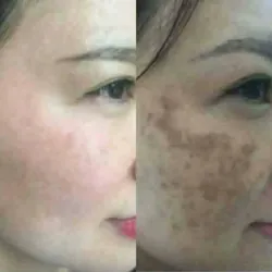Kem trị nám, thâm xách tay Hàn Quốc 971583