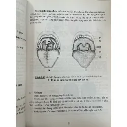 Viêm họng amidam và VA - PGS,TS. Nguyễn Hữu Khôi 719525
