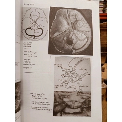Hình ảnh học sọ não - Jacques Clarisse, Nguyễn Thi Hùng, Phạm Ngọc Hoa 929913