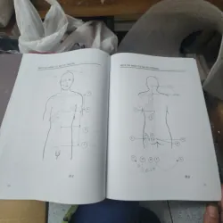 Tăng huyết áp các chứng liên đới -  chuyên khoa châm cứu 975372