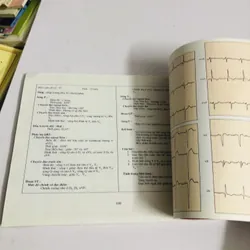 BÀI TẬP ĐIỆN TÂM ĐỒ (M. Englert – R. Bernard) 598068