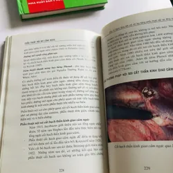 PHẪU THUẬT NỘI SOI LỒNG NGỰC  675226