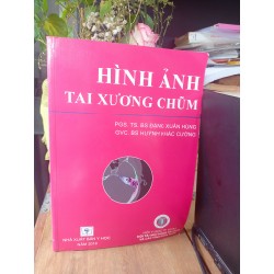 Hình ảnh tai xương chũm - Đặng Xuân Hùng