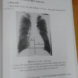 CHẨN ĐOÁN X QUANG  572267