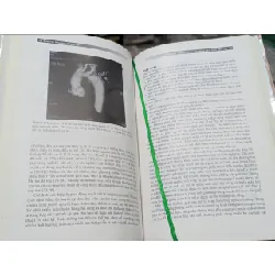 Bệnh tim bẩm sinh ở người lớn - Carole A.Warnes - Hiệu đính dịch thuật: PGS.TS.Phạm Nguyễn Vinh 271525