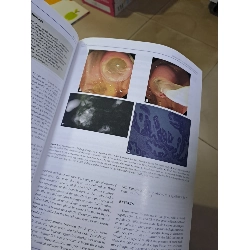 GIE Gastrointestinal Endoscopy volume 76 no 2 8/2012 HCM0808 TẠP CHÍ, THIẾT KẾ, THỜI TRANG 923606