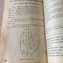 Châm cứu kết hợp cổ truyền với hiện đại, Lê Quý Ngưu 709492