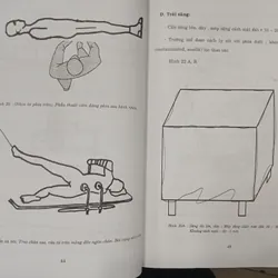 GÃY THÂN XƯƠNG ĐÙI - TỔN THƯƠNG, CHẨN ĐOÁN, ĐIỀU TRỊ 595415