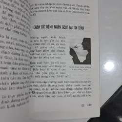 Viêm khớ -gout và loãng xương 995559