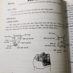 PHỤC HÌNH RĂNG CỐ ĐỊNH  462620