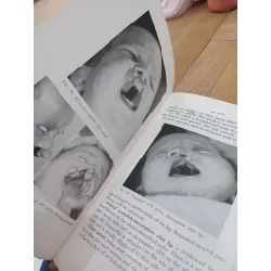 Anomalies of infants and children - D. McCullagh Mayer, Wilson A. Swanker 568307