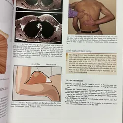 Atlas y khoa Hội chứng đau hiếm gặp  715543