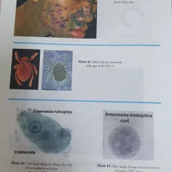 BỆNH TRUYỀN NHIỄM  1019164