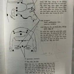 BẤM HUYỆT CÁCH CHỮA VÀ SỰ ÍCH LỢI - FM. HOUSTON, DC 996086