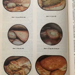 Bách khoa thư bệnh học 2, in năm 1994 1009151