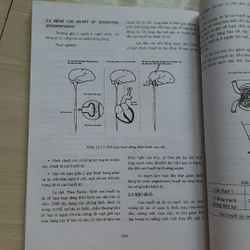 Cuốn photo MIẾN DỊCH - SINH LÝ BỆNH 325847