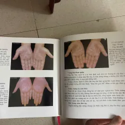 Chuẩn đoán bệnh qua vân tay 585366