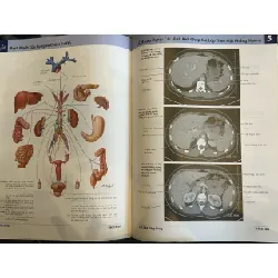 Atlas giải phẫu người - Frank H.Netter,MD 656444