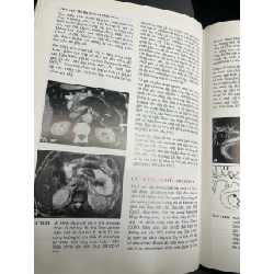 Sỏi đường mật - Nguyễn Đình Hối, Nguyễn Mậu Anh 790456