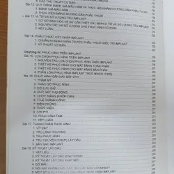 CẤY GHÉP NHA KHOA 740877