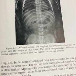 ORTHOPEDIC DISEASE  PHYSIOLOGY  PATHOLOGY  RADIOLOGY  470552