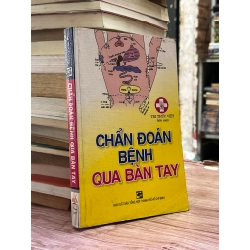 Chuẩn đoán bệnh qua bàn tay