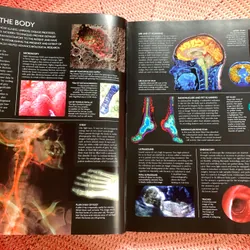 The Human Body Book: An Illustrated Guide to Its Structure, Function and Disorders. 646342