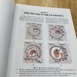 SIÊU ÂM SẢN KHOA THỰC HÀNH  974768