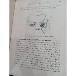 Ophtalmologie - A. Cantonnet 551398