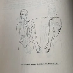 Châm cứu học, nhiều hình ảnh minh hoạ 608337