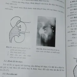 CHẨN ĐOÁN X QUANG  572267