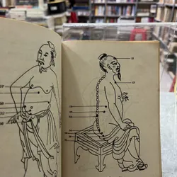 ĐIỂM HUYỆT GIẢI HUYỆT THIẾU LÂM TỰ 738119