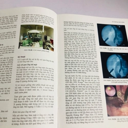 📚 SỎI ĐƯỜNG MẬT – Nguyễn Đình Hối, Nguyễn Mậu Anh 539457