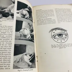 NURSING CARE OF THE PATIENT IN OPHTHALMIC SURGERY – ETHICON 756239