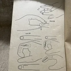 Gãy xương chị trên -1983 800113