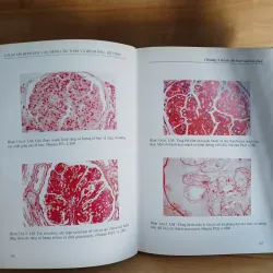 Atlast Mô Bệnh Học Các Bệnh Cầu Thận & Bệnh Ống - Kẽ Thận 799329