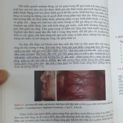 CẤY GHÉP NHA KHOA 740877