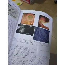 GIE Gastrointestinal Endoscopy volume 76 no 2 8/2012 HCM0808 TẠP CHÍ, THIẾT KẾ, THỜI TRANG 527154