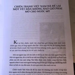 Chân trần chí thép 726323