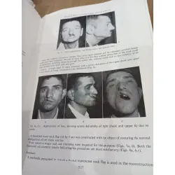 Transactions of the fourth international congress of plastic and reconstructive surgery 556684