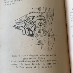 Cấp cứu tai mũi họng, Lê Văn Bích và Ngô Mạnh Sơn 709423