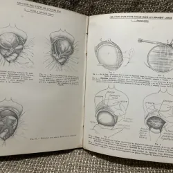 Kthuật phẫu thuật bằng hình ảnh -TECHNIQUE CHIRURGIEALE EN FIGURES G.JEANNENEY& J.MAGENDIE 1006345