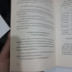 Bệnh thấp khớp 995572