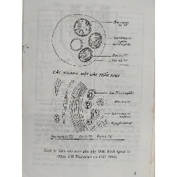 Bệnh học thần kinh - Hồ Hữu Lương 795925