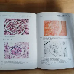 Atlast Mô Bệnh Học Các Bệnh Cầu Thận & Bệnh Ống - Kẽ Thận 799329