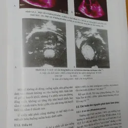 BỆNH HỌC TIM MẠCH  593432