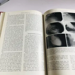 CARDIOLOGY CLINICS – Coronary angioplasty - BÌA CỨNG, KHỔ TO 698172