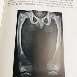 ORTHOPEDIC DISEASE  PHYSIOLOGY  PATHOLOGY  RADIOLOGY  470552