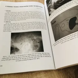 Combo 2 cuốn Tai Mũi Họng (Quyển 1 & Quyển 2) – Chủ biên: Nhan Trừng Sơn 925808